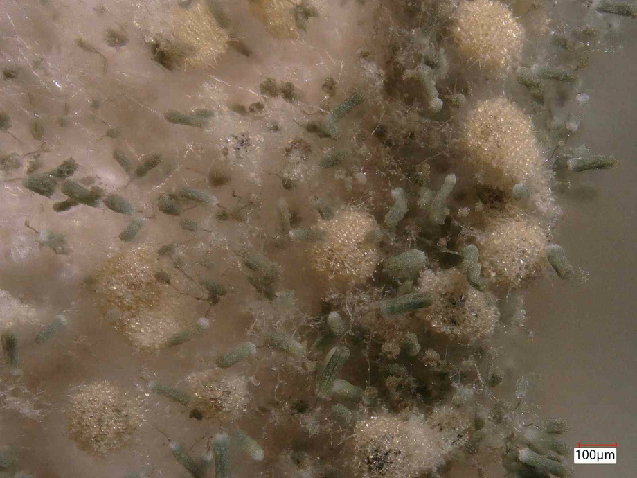 Mikroskopische Aufnahme von mikrobiellem Befall auf Papier in 100facher Vergrößerung.
